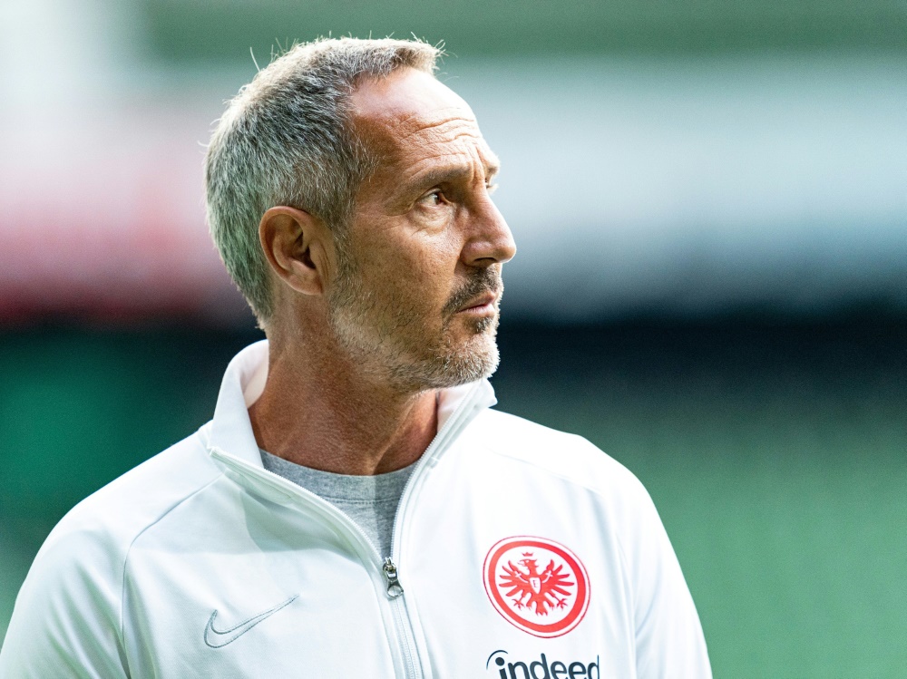 Adi Hütter ist seit 2018 Trainer von Eintracht Frankfurt