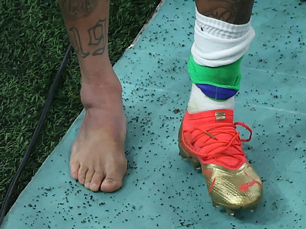 Brasiliens Superstar Neymar erlitt gegen Serbien eine Knöchelverletzung. (Foto: AFP/SID/GIUSEPPE CACACE)